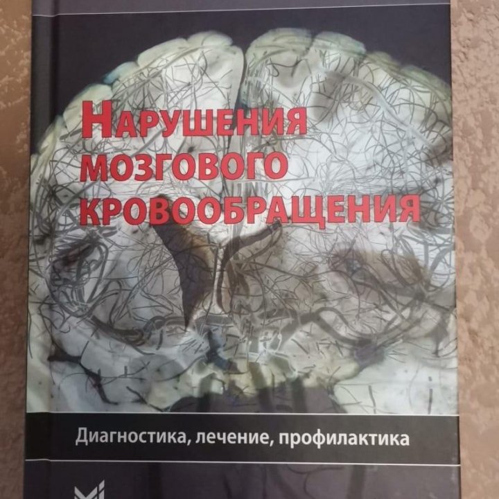 Книга нарушение мозгового кровообращения